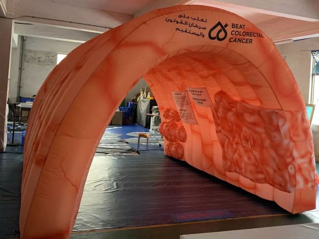 inflatable colon COLORECTAL  cancer